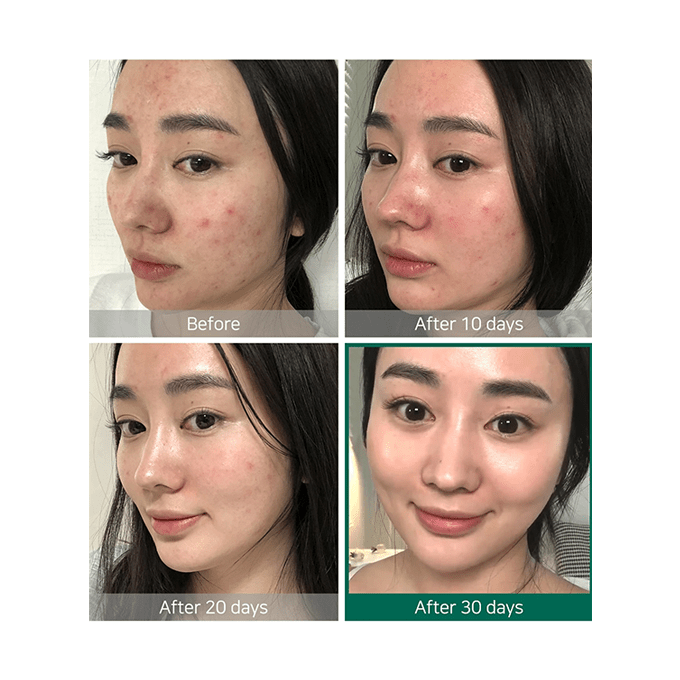 Some By Mi AHA. BHA. PHA 30 Days Miracle Toner